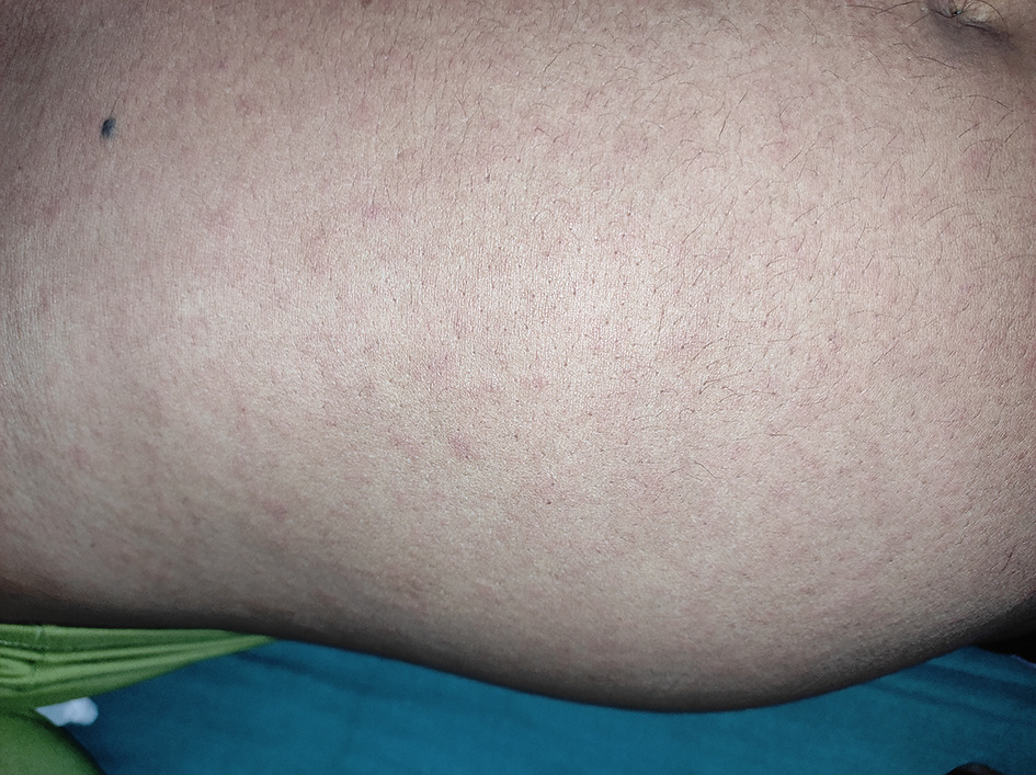 Fig 1