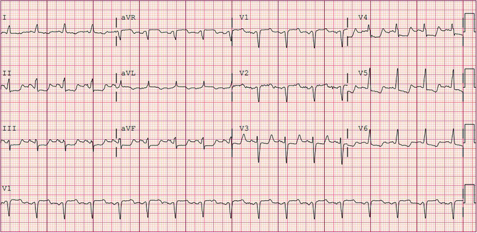 Fig 3